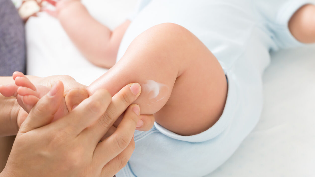 乳幼児の皮膚トラブルは丁寧なケアと早めの治療がポイント